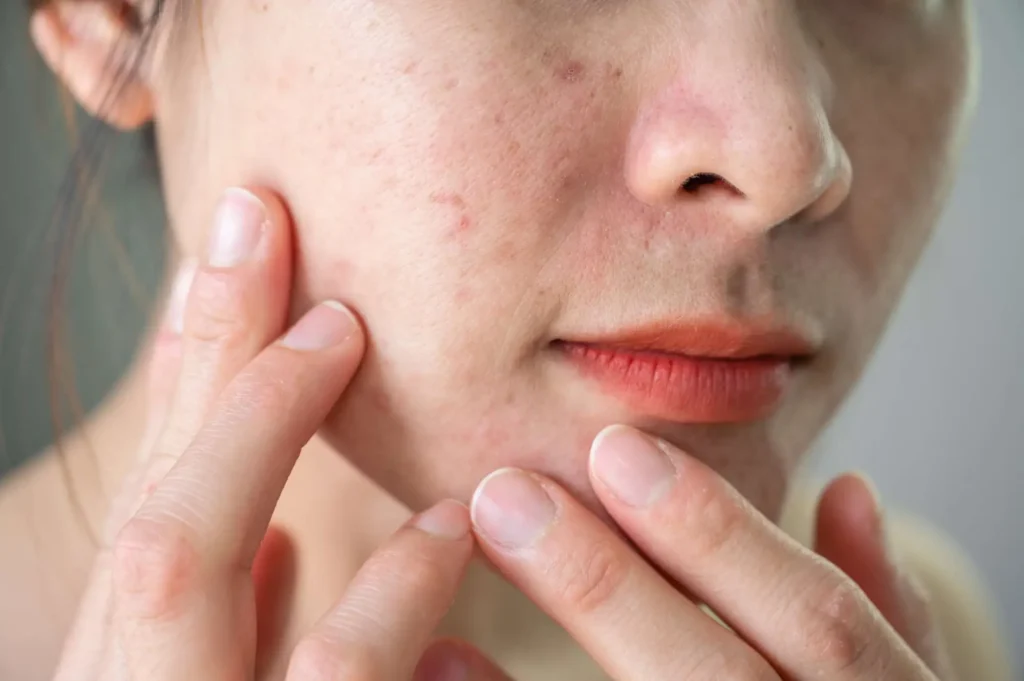 Your Makeup Separates or Looks Uneven by Midday